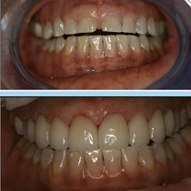 before-afterpatty