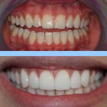 darcia-before-after