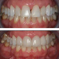ba-linda-veneers family and cosmetic dentistry