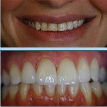 dana-before-after