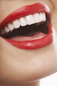 Photo of a woman's beautiful white smile.
