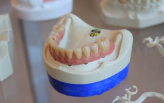 how to make your dental crowns last